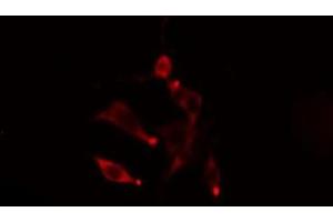 ABIN6275470 staining  LOVO cells by IF/ICC. (Rab5c anticorps  (Internal Region))