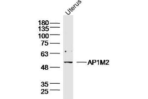 Mouse Uterus lysates probed with AP1M2 Polyclonal Antibody, unconjugated  at 1:300 overnight at 4°C followed by a conjugated secondary antibody for 60 minutes at 37°C. (AP1m2 anticorps  (AA 1-100))