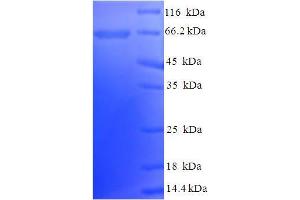 SDS-PAGE (SDS) image for Natriuretic Peptide Receptor B/guanylate Cyclase B (Atrionatriuretic Peptide Receptor B) (NPR2) (AA 23-458), (Extracellular) protein (His-SUMO Tag) (ABIN5710025)