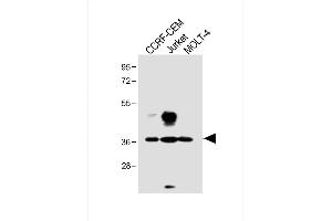 All lanes : Anti-TAL1 Antibody (T90) at 1:1000 dilution Lane 1: CCRF-CEM whole cell lysate Lane 2: Jurkat whole cell lysate Lane 3: MOLT-4 whole cell lysate Lysates/proteins at 20 μg per lane. (TAL1 anticorps  (AA 68-97))