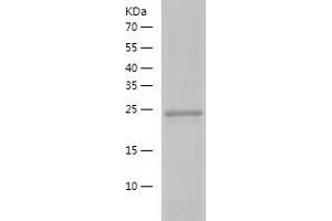 Western Blotting (WB) image for RAB18, Member RAS Oncogene Family (RAB18) (AA 1-206) protein (His tag) (ABIN7124739)