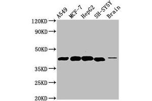 Western Blot Positive WB detected in: A549 whole cell lysate, MCF-7 whole cell lysate, HepG2 whole cell lysate, SH-SY5Y whole cell lysate, Rat brain tissue All lanes: DLK1 antibody at 4. (DLK1 anticorps  (AA 24-303))