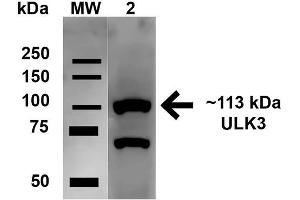 Western blot analysis of Human HeLa cell lysates showing detection of 112. (ULK2 anticorps  (AA 558-569) (Atto 488))
