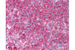 Anti-CD82 antibody IHC of human spleen. (CD82 anticorps  (C-Term))