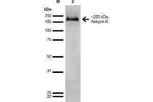 Western Blot analysis of Rat Brain showing detection of ~200 kDa Ankyrin-R protein using Mouse Anti-Ankyrin-R Monoclonal Antibody, Clone S388A-10 . (Erythrocyte Ankyrin anticorps  (AA 1-1881) (Atto 390))