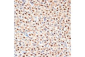 Immunohistochemistry of paraffin-embedded rat ovary using CDC16 Rabbit mAb (ABIN1678585, ABIN3017837, ABIN3017838 and ABIN7101525) at dilution of 1:100 (40x lens). (CDC16 anticorps)