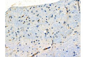 ABIN6261585 and ABIN6276414 at 1/100 staining Mouse brain tissue by IHC-P.