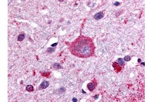 Image no. 1 for anti-G Protein-Coupled Receptor, Family C, Group 5, Member B (GPRC5B) (C-Term) antibody (ABIN181444)