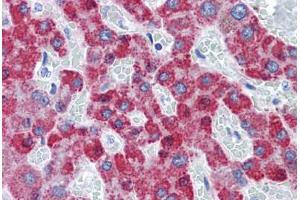 anti-TAO Kinase 2 (TAOK2) (AA 831-931) antibody