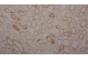 Detection of TF in Human Kidney Tissue using Polyclonal Antibody to Transferrin (TF) (Transferrin anticorps  (AA 361-683))
