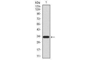 Image no. 2 for anti-HIR Histone Cell Cycle Regulation Defective Homolog A (HIRA) antibody (ABIN1490946) (HIRA anticorps)