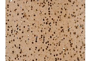 ABIN7094647 and ABIN7098698 at 1/100 staining Rat brain tissue by IHC-P. (ANAPC7 anticorps  (C-Term))