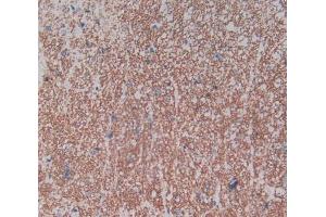 Used in DAB staining on fromalin fixed paraffin- embedded spinal cord tissue