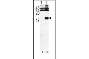 Image no. 1 for anti-beta-2-Microglobulin (B2M) (C-Term) antibody (ABIN357932) (beta-2 Microglobulin anticorps  (C-Term))