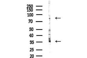 anti-Myristoylated Alanine-Rich Protein Kinase C Substrate (MARCKS) (Internal Region) antibody