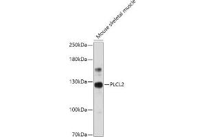 Western blot analysis of extracts of Mouse skeletal muscle, using PLCL2 antibody (ABIN7269344) at 1:1000 dilution. (PLCL2 anticorps  (AA 130-300))