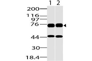 Image no. 1 for anti-DEAD (Asp-Glu-Ala-Asp) Box Polypeptide 18 (DDX18) (AA 20-300) antibody (ABIN5027137) (DDX18 anticorps  (AA 20-300))