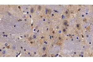 Detection of NPS in Rat Cerebrum Tissue using Polyclonal Antibody to Neuropeptide S (NPS)
