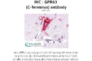 Image no. 1 for anti-G Protein-Coupled Receptor 63 (GPR63) (C-Term) antibody (ABIN1735144) (GPR63 anticorps  (C-Term))