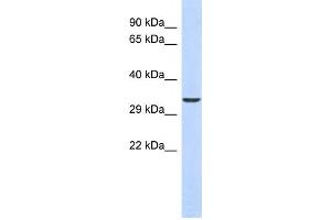 Western Blotting (WB) image for anti-Ventral Anterior Homeobox 1 (VAX1) antibody (ABIN2458264) (VAX1 anticorps)