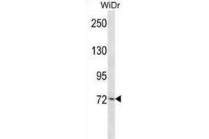 Western Blotting (WB) image for anti-Polo-Like Kinase 3 (PLK3) antibody (ABIN2998167)
