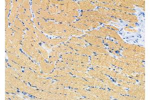 ABIN6266284 and ABIN6277438 at 1/100 staining Rat muscle tissue by IHC-P. (TPM2 anticorps  (C-Term))
