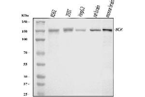 Western blot analysis of Bcr using anti-Bcr antibody (ABIN4886483). (BCR anticorps  (AA 1-100))
