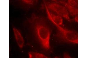 Immunofluorescence staining of methanol-fixed Hela cells showing cytoplasmic staining using MKK6(Phospho-Ser207) Antibody.