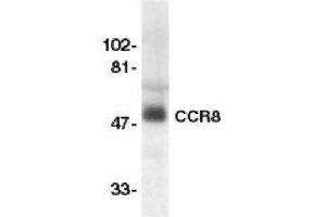 Western Blotting (WB) image for anti-Chemokine (C-C Motif) Receptor 8 (CCR8) antibody (ABIN2472922) (CCR8 anticorps)