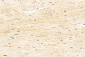 Immunohistochemistry analysis of paraffin-embedded mouse heart using,MYLK3 (ABIN7074736) at dilution of 1: 1200