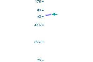 SDS-PAGE (SDS) image for Sulfotransferase Family 1B Member 1 (SULT1B1) (AA 1-296) protein (GST tag) (ABIN1321868)
