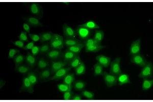 Immunofluorescence analysis of U2OS cells using MAD1L1 Polyclonal Antibody (MAD1L1 anticorps)