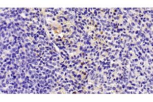 Detection of IL8 in Human Spleen Tissue using Monoclonal Antibody to Interleukin 8 (IL8) (IL-8 anticorps  (AA 28-99))