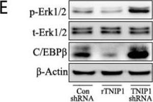 TNIP1 modulates the proliferation of keratinocytes by targeting Erk1/2 and C/EBPβ. (CEBPB anticorps  (N-Term))