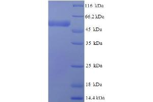Isocitrate Dehydrogenase 3 (NAD+) gamma (IDH3G) (AA 40-393) protein (His-SUMO Tag)