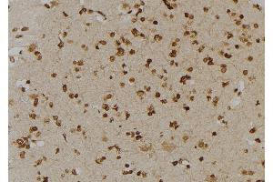 ABIN6277006 at 1/100 staining Human brain tissue by IHC-P. (PSMD2 anticorps  (C-Term))