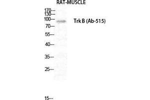 Western Blot (WB) analysis of Rat Muscle cells using Trk B Polyclonal Antibody.