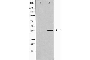 Western blot analysis of LEG9 expression in HepG2 cells,The lane on the left is treated with the antigen-specific peptide. (Galectin 9 anticorps  (Internal Region))
