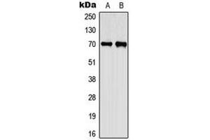 Western blot analysis of CEP70 expression in A549 (A), PC12 (B) whole cell lysates. (CEP70 anticorps  (Center))
