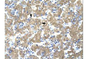 Image no. 1 for anti-Acetyl-CoA Acetyltransferase 2 (ACAT2) (AA 174-223) antibody (ABIN202424)