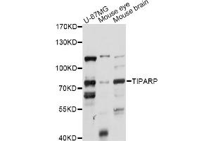 Western blot analysis of extracts of various cell lines, using TIPARP antibody (ABIN6292494) at 1:1000 dilution.
