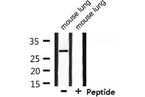 Western blot analysis of extracts from mouse lung, using RNF144A Antibody.