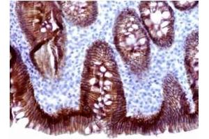 Image no. 1 for anti-Cadherin 1, Type 1, E-Cadherin (Epithelial) (CDH1) antibody (ABIN459320) (E-cadherin anticorps)