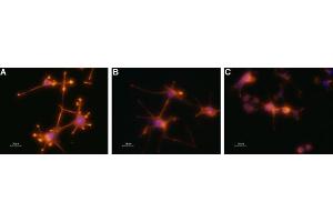Taipoxin changes the actin filaments distribution in the growing neurite tip bulge of differentiated PC12 cells.