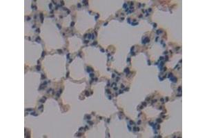 IHC-P analysis of Mouse Tissue, with DAB staining. (GSTA4 anticorps  (AA 1-222))