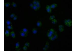 Immunofluorescence staining of PC3 cells with ABIN7140185 at 1:50, counter-stained with DAPI. (TGFBR3L anticorps  (AA 242-258))