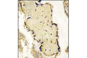 Formalin-fixed and paraffin-embedded placenta tissue reacted with SPPL2a Antibody (N-term), which was peroxidase-conjugated to the secondary antibody, followed by DAB staining.