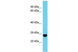Host: Rabbit Target Name: FAM204A Sample Type: Jurkat Whole Cell lysates Antibody Dilution: 1. (FAM204A anticorps  (N-Term))