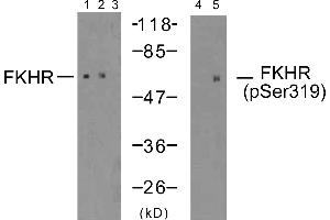 Western blot analysis of extracts using FKHR (Ab-319) antibody (Line 1, 2 and 3) and FKHR (phospho-Ser319) antibody (Line 4 and 5). (FOXO1 anticorps  (Ser319))
