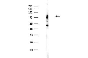 anti-DEAQ Box RNA-Dependent ATPase 1 (DQX1) (Internal Region) antibody